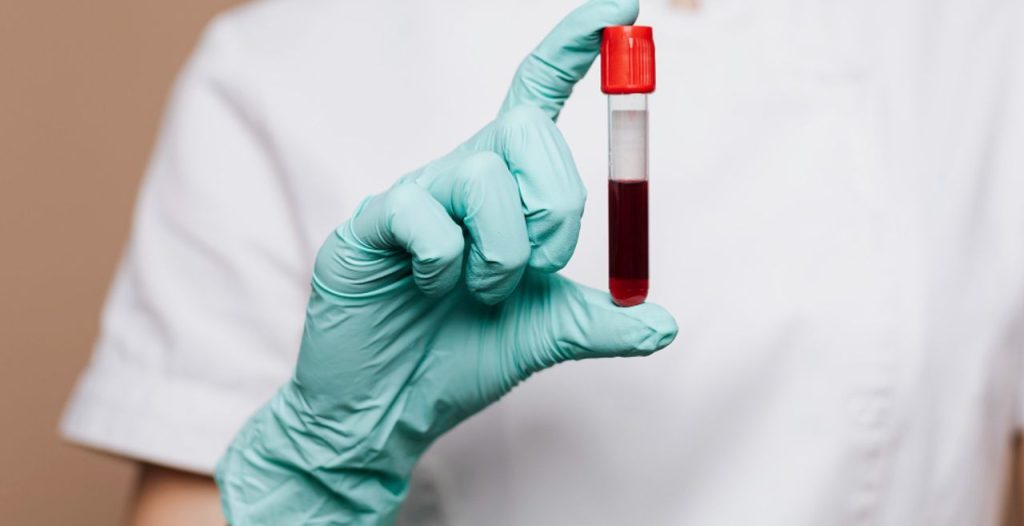 bacteremia o o que e infeccao no sangue