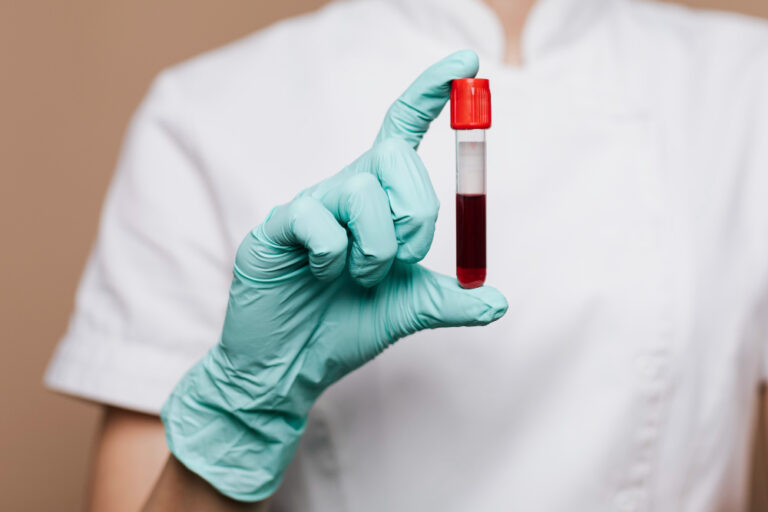 anemia comum e anemia causada pela SMD