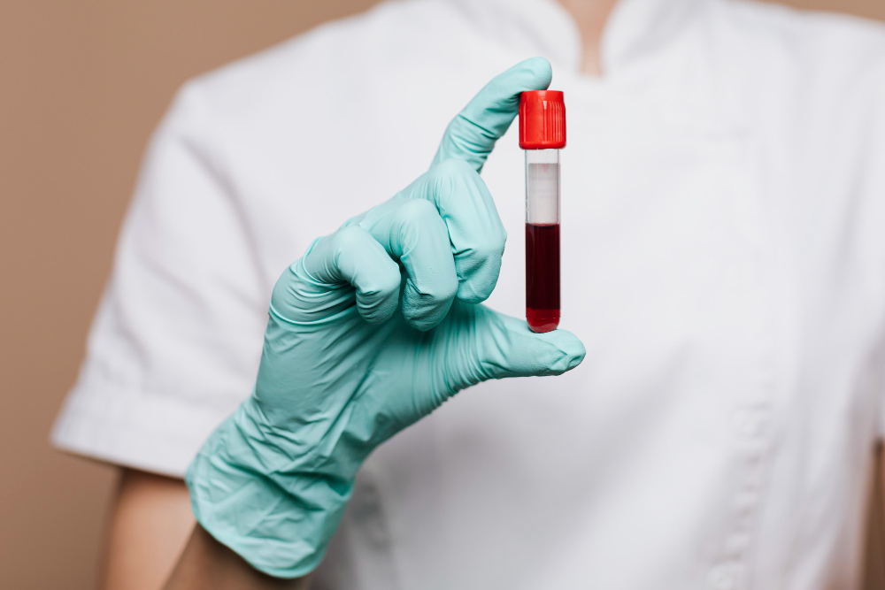 anemia comum e anemia causada pela SMD
