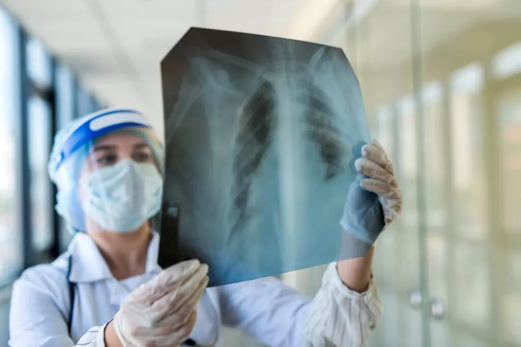 o que é embolia pulmonar